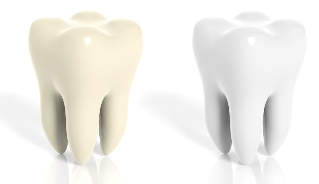 Teeth whitening in Keswick, featuring a professional dental treatment procedure.